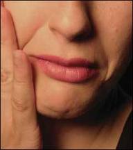 асимметрия лица неврит лицевого нерва